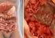 Ai aceste simptome? Mergi de URGENŢĂ la medic! E cancer de colon