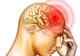 Corpul tău te avertizează cu o lună înainte de a face un accident vascular cerebral - vezi CUM!