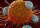 Simptome ale cancerului ovarian pe care multe femei le ignoră