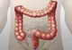 Cum scapi de 6 kilograme de OTRAVĂ din colon. Metoda este surprinzătoare