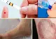 Aşa apare DIABETUL. Patru simptome pe care toată lumea le ignoră