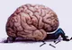 Boala Alzheimer poate fi prevenită și combătută. Află părerea unui specialist