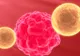 Ce trebuie să știi despre cancerul de pancreas