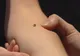 Cum îndepărtezi o căpuşă simplu şi în siguranţă. VIDEO
