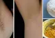 Cum poţi scăpa de părul de la subraţ chiar la tine acasă! O soluţie naturală 100%