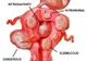 Fibromul uterin. Simptomele care ar trebui să alarmeze femeile. Durerea de spate, una dintre ele 