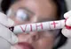Primele semne care te anunţă că ai fost infectat cu HIV. Mergi de urgenţă la medic dacă le ai