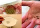A încercat acest remediu pentru a-şi curăţa rinichii de toxine. Iată ce a păţit după 4 zile!