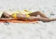 Aceste afecţiuni se agravează dacă stai la plajă. Iată ce trebuie să faci