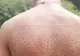 A ajuns la piscină și s-a dezbrăcat! Prietenii au rămas șocați când au văzut ce i-a apărut pe spate