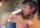 Drama unui copil din India: Suferă de o boală extrem de rară și nimeni nu vrea să se aproprie de el
