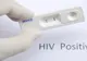 Primul test pentru HIV care poate fi făcut acasă. Funcționează pe baza unei probe de salivă