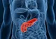 "Cancerul tăcut" - Primele simptome ascunse ale unuia dintre cele mai agresive forme de cancer