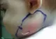 A văzut un fir alb pe obrazul fiicei sale, dar când a tras de el a avut un ȘOC! A fugit la medic