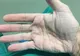 VIRAL. Cum arată mâna unui cardiolog, după 12 ore de operaţie, la 30 de grade