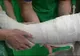 Un chirurg ortoped şi-a rupt piciorul chiar la intrarea în sala de operaţie
