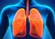 Dieta care poate preveni cancerul pulmonar