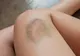 Simptome ale cancerului pe care femeile le ignoră cel mai des