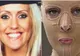 I-a dat foc acestei blonde din cauză că era prea frumoasă. Cum arată fata după reconstrucţia pielii