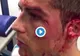 Imagini crunte cu Cristiano Ronaldo, accidentat 