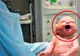 Medicii au rămas cu gura căscată! Așa ceva nu s-a mai întâmplat niciodată