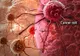 Aproape de o descoperire epocală? Un vaccin împotriva cancerului a reușit să elimine tumorile