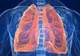 Veste uriaşă pentru bolnavii cu cancerul pulmonar: Un nou tratament are rezultate excelente
