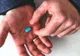 Viagra. Tocmai au descoperit un efect secundar incredibil al pilulei Viagra. Medicii, entuziasmaţi