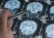 Neurochirurg cunoscut: "Cel mai comun simptom al unei tumori cerebrale e acest tip de durere de cap"