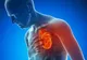 Lipsa unei vitamine arhicunoscute creşte riscul de infarct