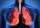 Al doilea transplant pulmonar bilateral, efectuat la Spitalul "Sf. Maria"