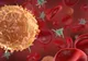 Medicii trag un semnal de alarmă: Lipsa acestei vitamine duce la apariţia cancerului
