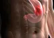 Cum se transmite bacteria care cauzează cancer de stomac