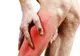 Ce pericol deosebit de grav pot indica crampele musculare 