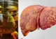 Avertismentul medicilor: acest ceai te poate îmbolnăvi de hepatită!