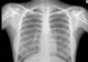 Cât de periculoase sunt radiografiile pentru organism