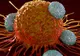Medicii trag un semnal de alarmă: Lipsa acestei vitamine duce la apariţia cancerului!