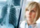 Focarul de pneumonie face noi victime în Argentina: 6 morți. Medicii au stabilit cauza îmbolnăvirilor misterioase
