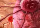 Descoperirea care ar putea revoluţiona tratamentul împotriva CANCERULUI. E uimitor 