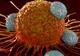 Raport dramatic. Peste 55.000 de cazuri noi de cancer înregistrate în România, în ultimele luni