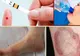 Aşa apare DIABETUL. Patru simptome pe care toată lumea le ignoră