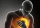 5 reguli de AUR pentru prevenirea bolilor cardio-vasculare și a infarctului