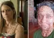 Femeia cu peste 6.000 de tumori pe trup a fost operată. Cum arată ACUM a şocat şi mai rău