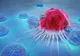 Cancer. Motivul incredibil pentru care cei mai mulţi oameni fac cancer
