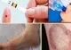 Aşa apare DIABETUL. Patru simptome pe care toată lumea le ignoră