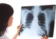 Scandalul radiografiilor de la Spitalul Slatina. Unele aparțineau altor medici