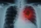 A muncit o viață ca vânzător și asta i-a dat cancer! Cum s-a ajuns la situația absurdă