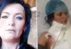 Credea că are o carie. La dentist, a venit șocul: înăuntru era un gândac care-i devora carnea