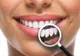 În ce situații nu este posibil implantul dentar