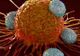 PAS URIAȘ în lupta împotriva cancerului: "80-90% din celulele canceroase au murit"